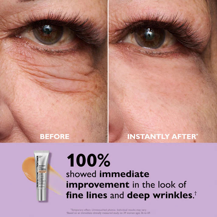 Revitalizing Eye Cream | Targets Dark Circles & Wrinkles | Instant Refreshing Effect