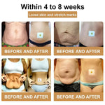 Body Care | Bee Venom & Herbal Extract Patches | Slimming Patch