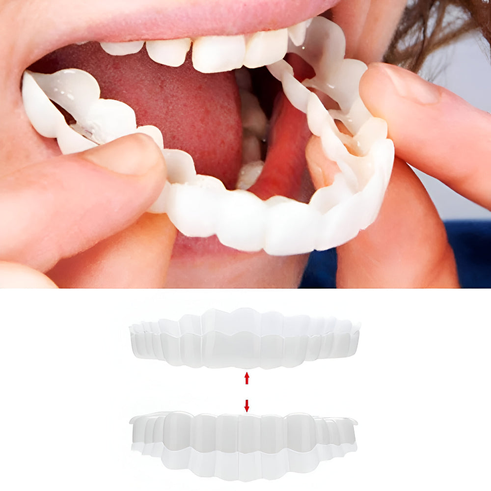 Silicone Tooth Covers for a Beautiful Smile
