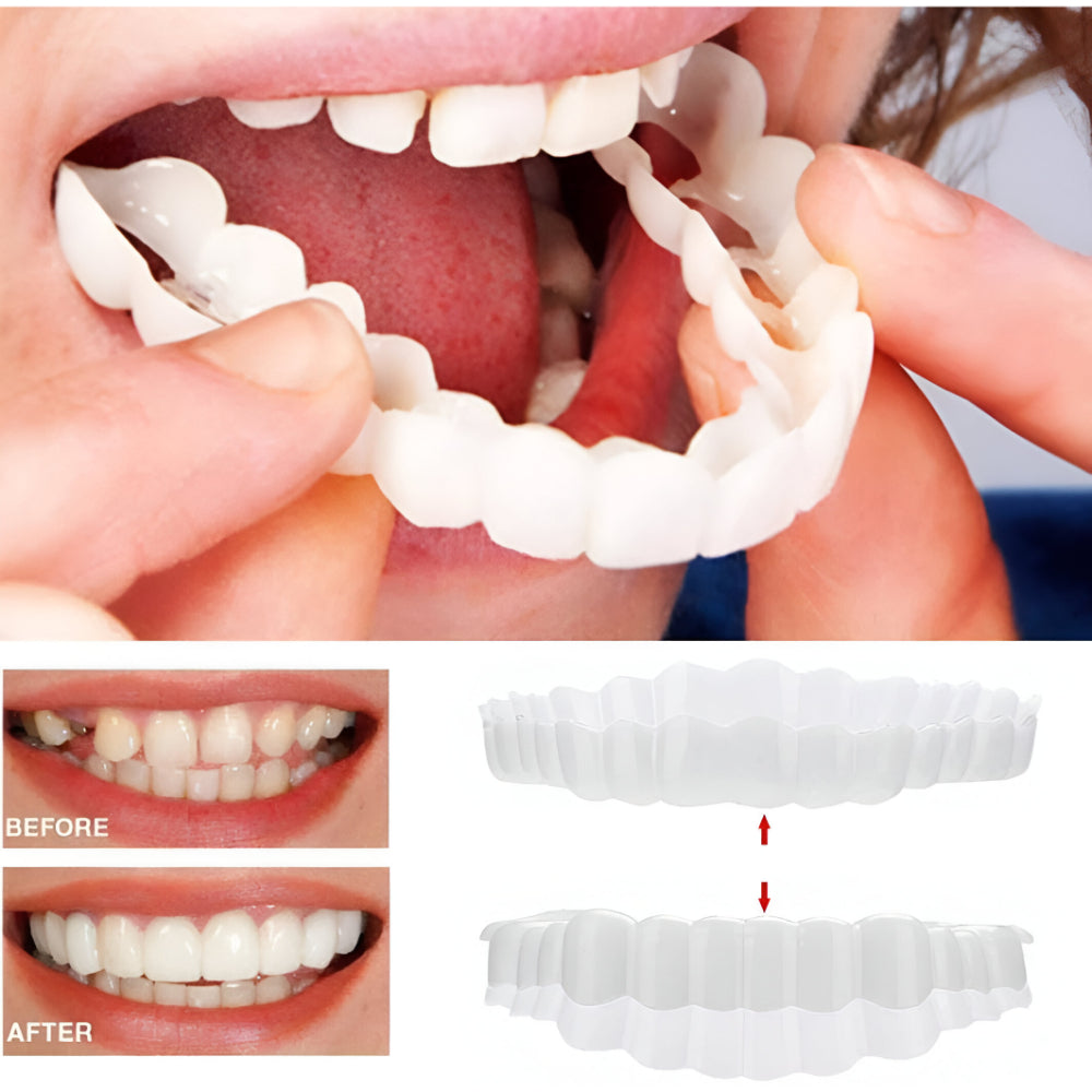 Silicone Tooth Covers for a Beautiful Smile
