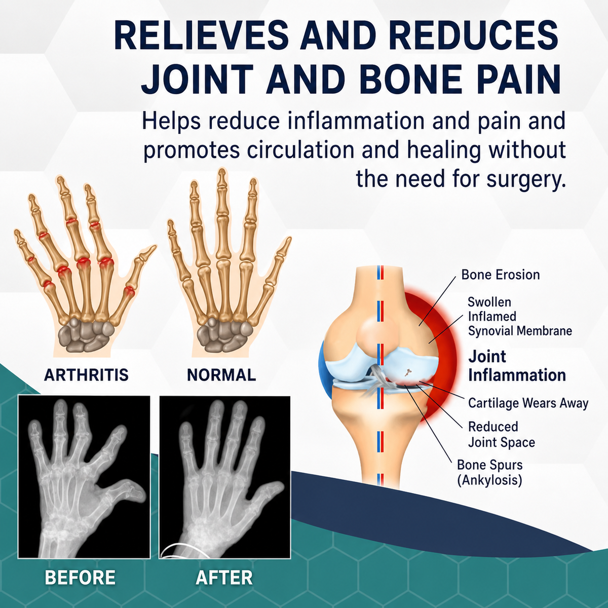 Pain Relief | Bee Venom Joint Care | Warming Deep Effect Massage