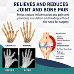 Pain Relief | Bee Venom Joint Care | Warming Deep Effect Massage