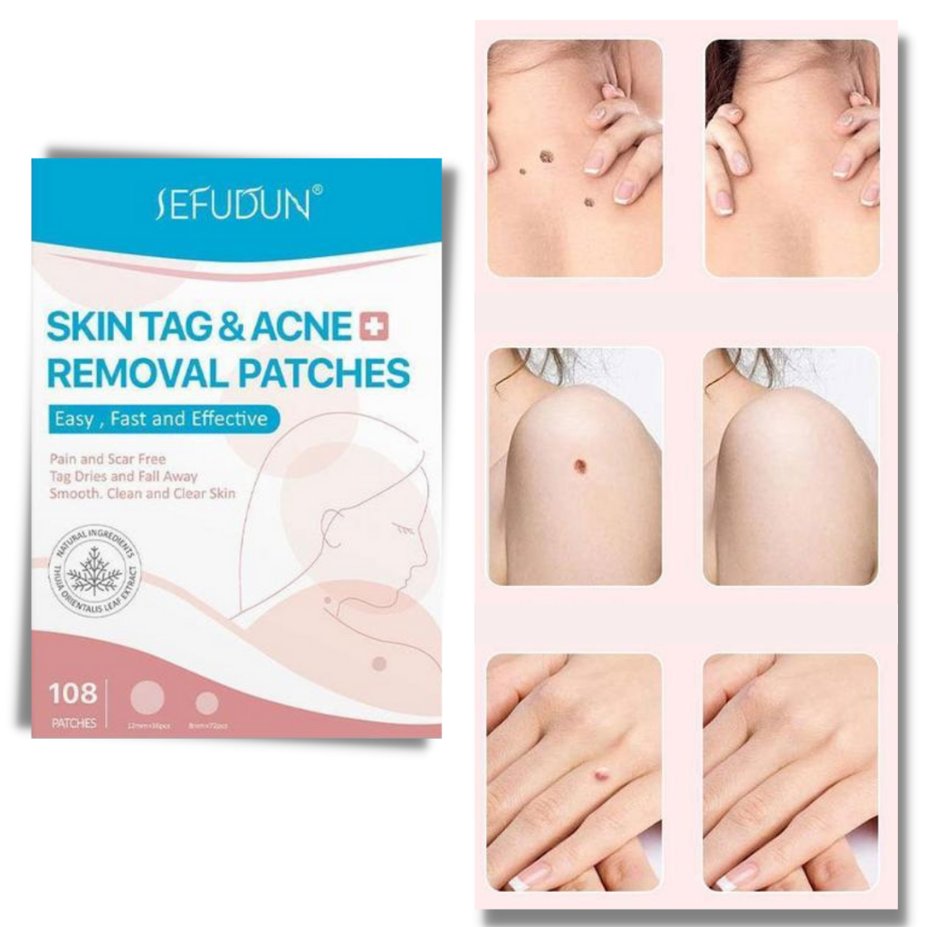 Natural Skin Patch - Effectively Remove Moles and Warts!