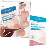 Natural Skin Patch - Effectively Remove Moles and Warts!
