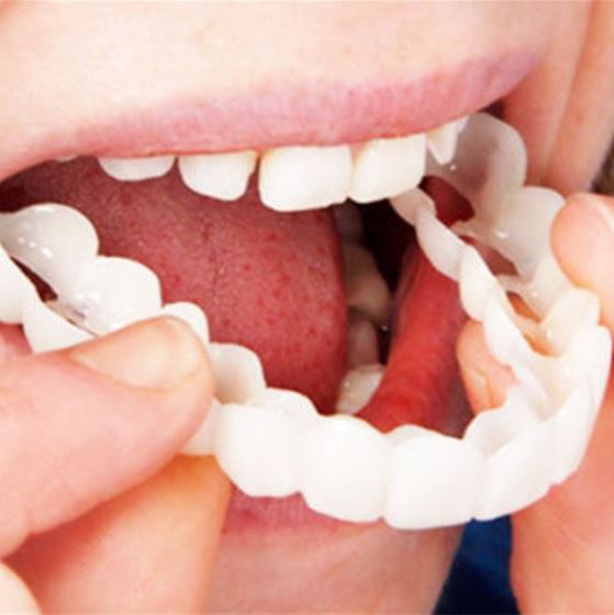 Veneers | Flexible Fit without Adhesive | Ideal for Eating, Drinking, and Daily Use