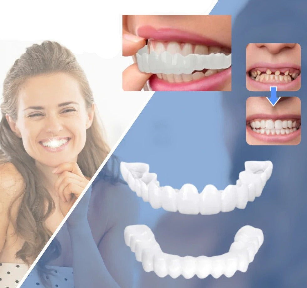 Veneers | Flexible Fit without Adhesive | Ideal for Eating, Drinking, and Daily Use