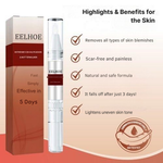 Wart Remover | Precision Applicator for Targeted Treatment | Plant-Based Care Formula