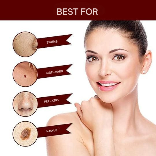 Wart Remover | Precision Applicator for Targeted Treatment | Plant-Based Care Formula
