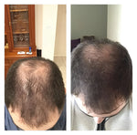 Natural Hair Growth Shampoo | Buy One, Get One Free