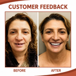 Dental Prosthesis | Soft Silicone Cushion | Non-Slip Fit Without Pressure Points