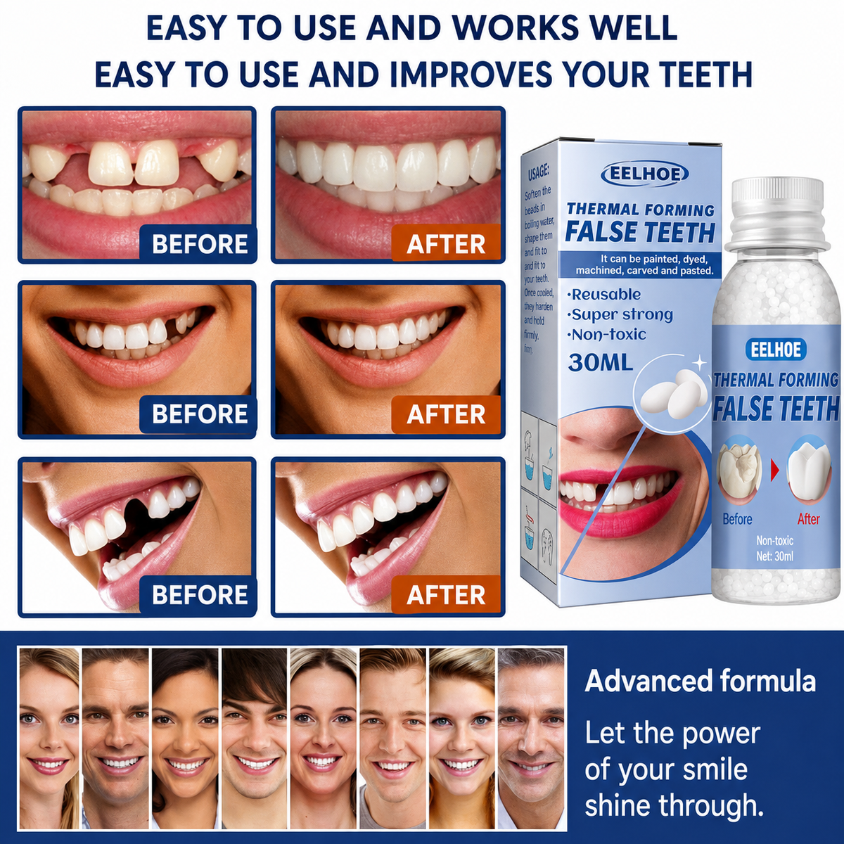 Dental Care | Tooth Repair Kit | Instant Tooth Gap Filling