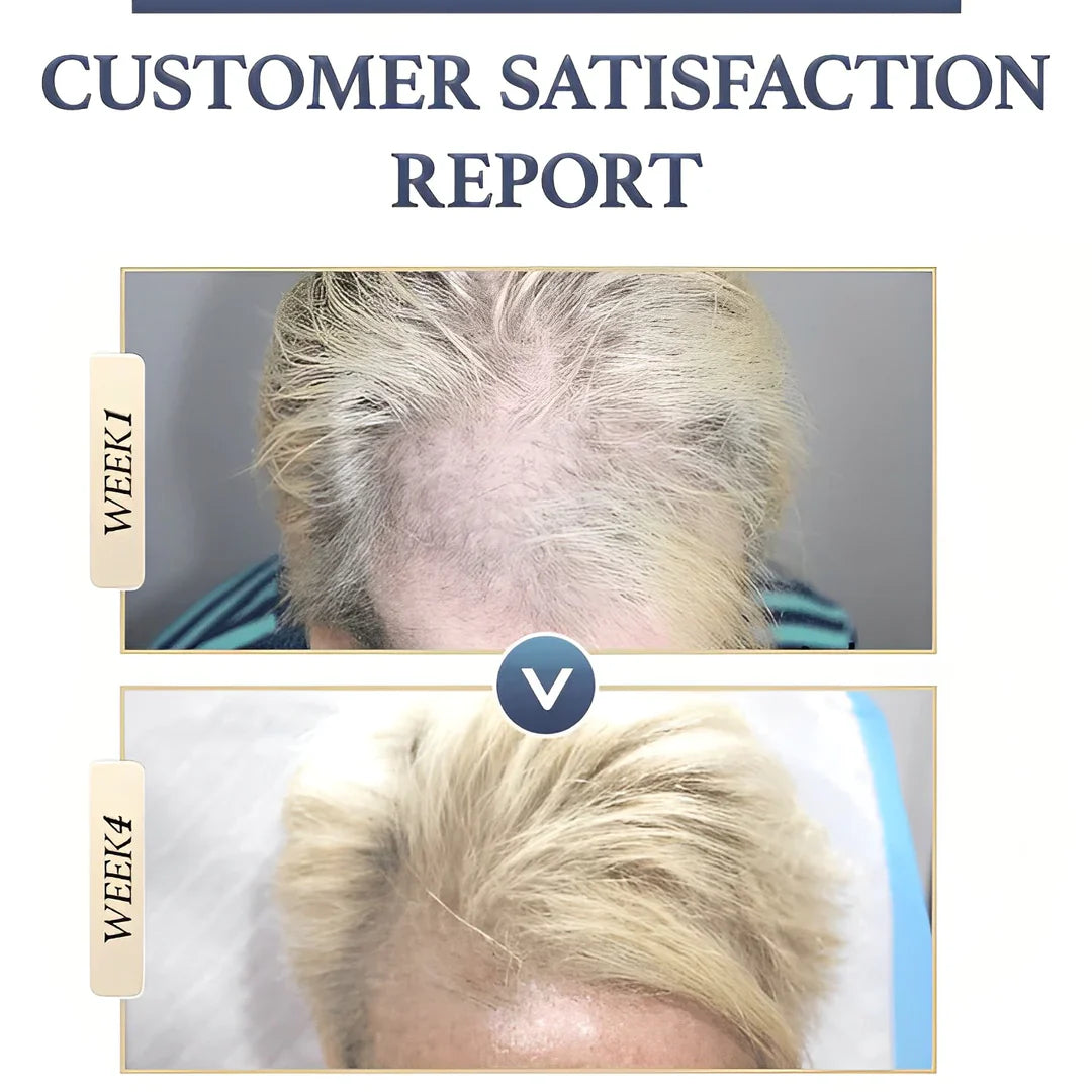 Natural Hair Growth Shampoo | Buy One, Get One Free
