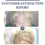 Natural Hair Growth Shampoo | Buy One, Get One Free