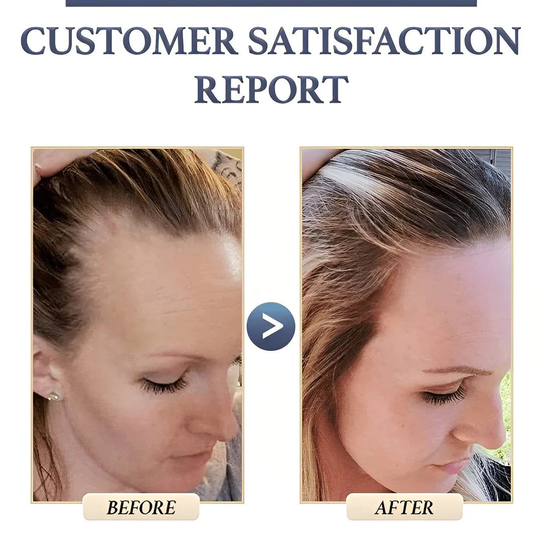 Natural Hair Growth Shampoo | Buy One, Get One Free