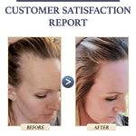 Natural Hair Growth Shampoo | Buy One, Get One Free
