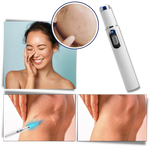 Compact Skin Laser Device for Scar and Discoloration Treatment