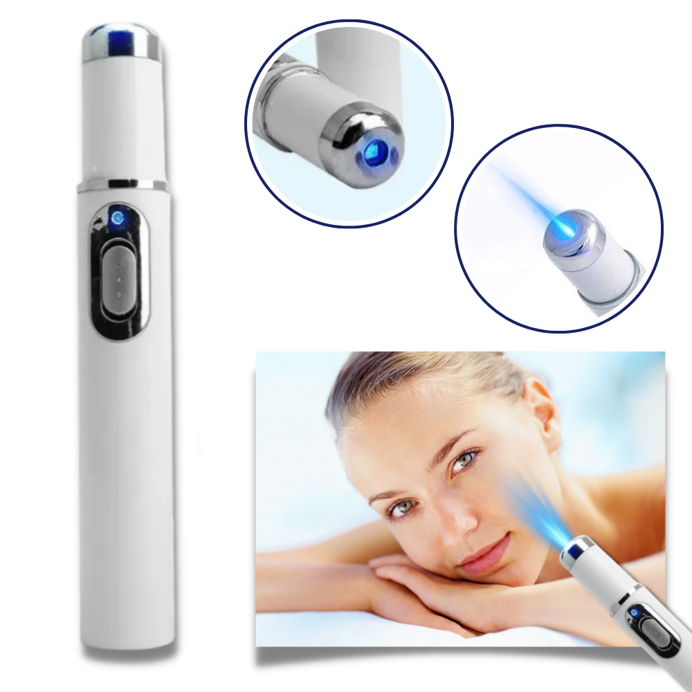 Compact Skin Laser Device for Scar and Discoloration Treatment