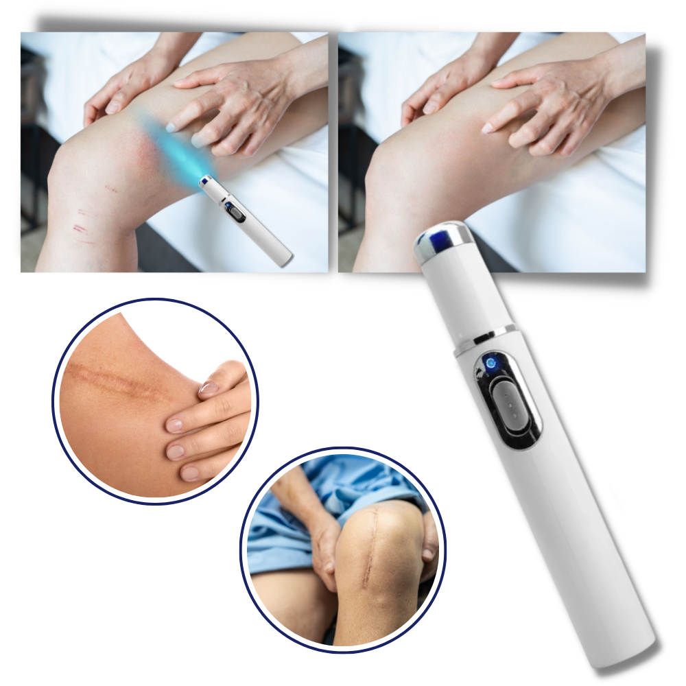 Compact Skin Laser Device for Scar and Discoloration Treatment