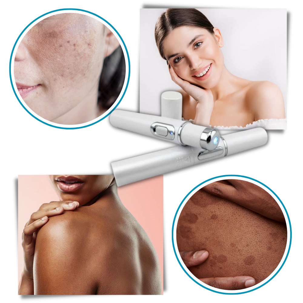 Compact Skin Laser Device for Scar and Discoloration Treatment
