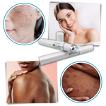Compact Skin Laser Device for Scar and Discoloration Treatment