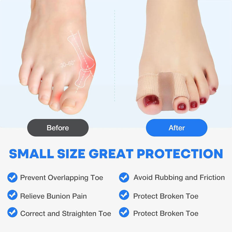 Gentle Toe Correction – Buy 1 Get 1 FREE