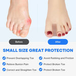 Gentle Toe Correction – Buy 1 Get 1 FREE