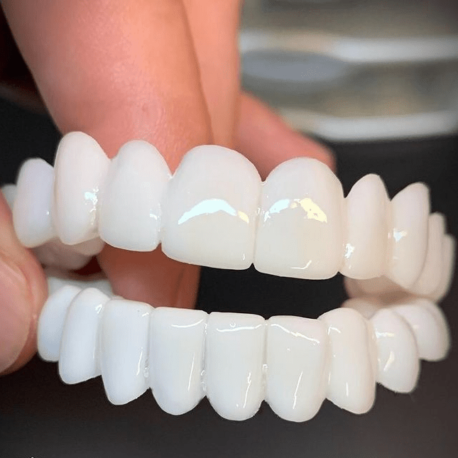 Dental Prosthesis with White Dental Lenses