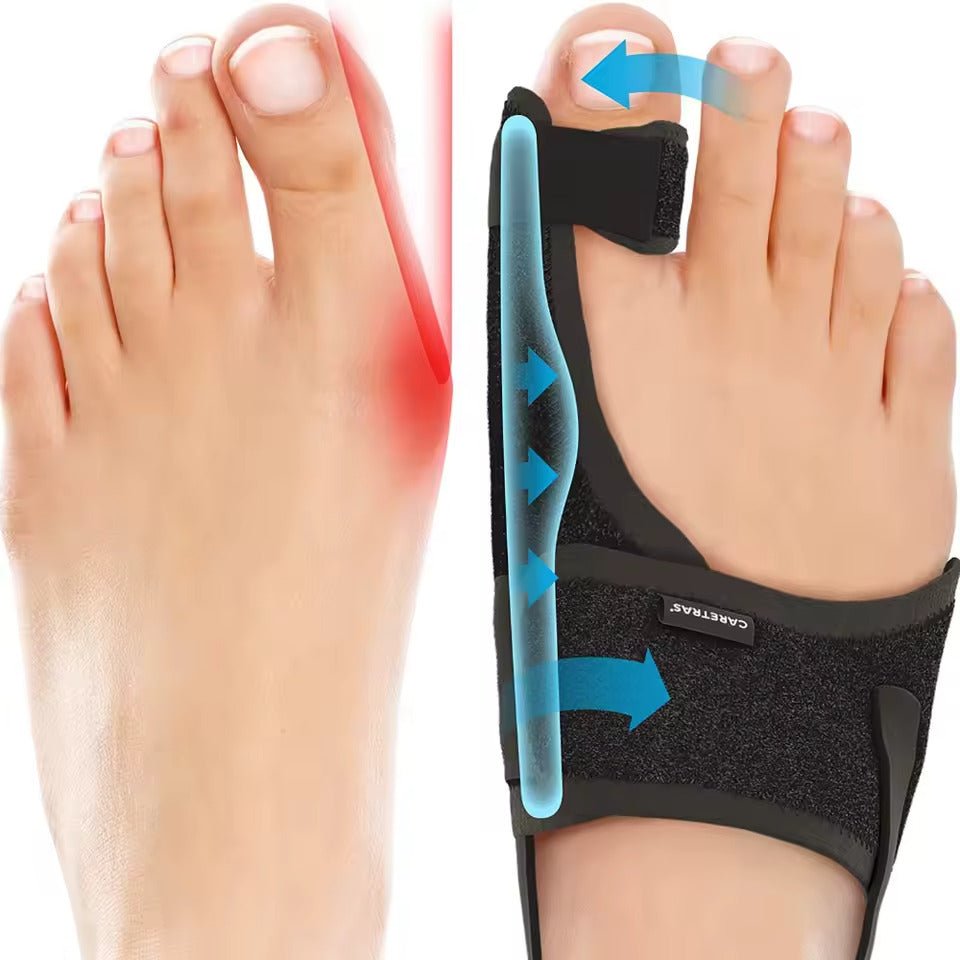 Ergonomic and Adjustable Night Splint for Hallux Valgus - Comfort Design